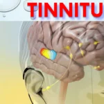 KOSA Acupuncture for Tinnitus