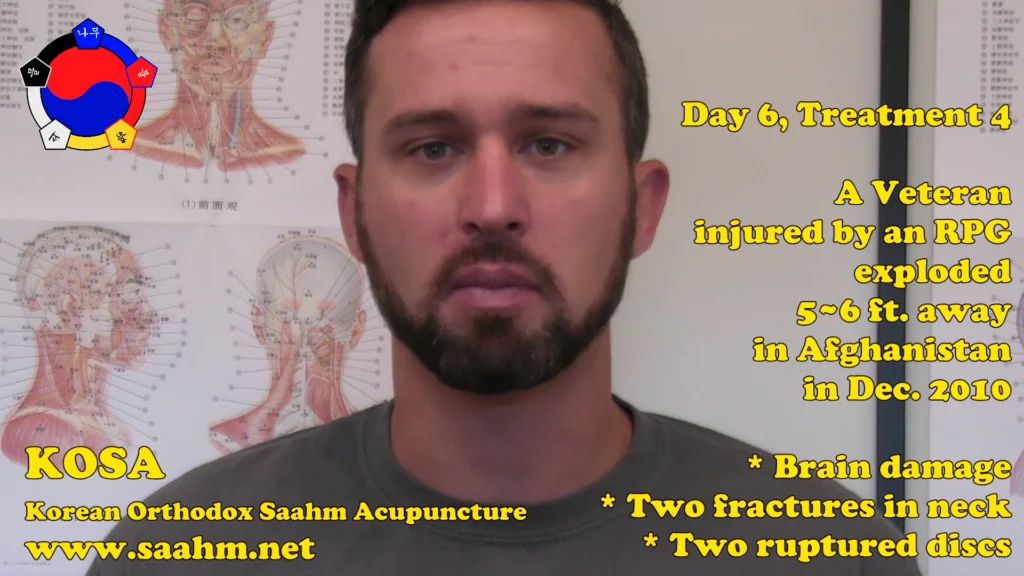 Veteran Patient Treatment