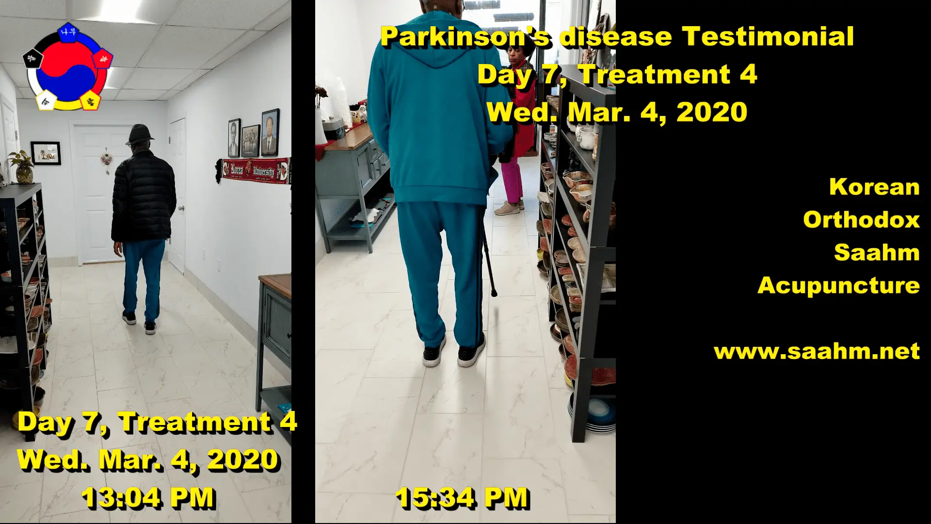 Parkinson's Disease