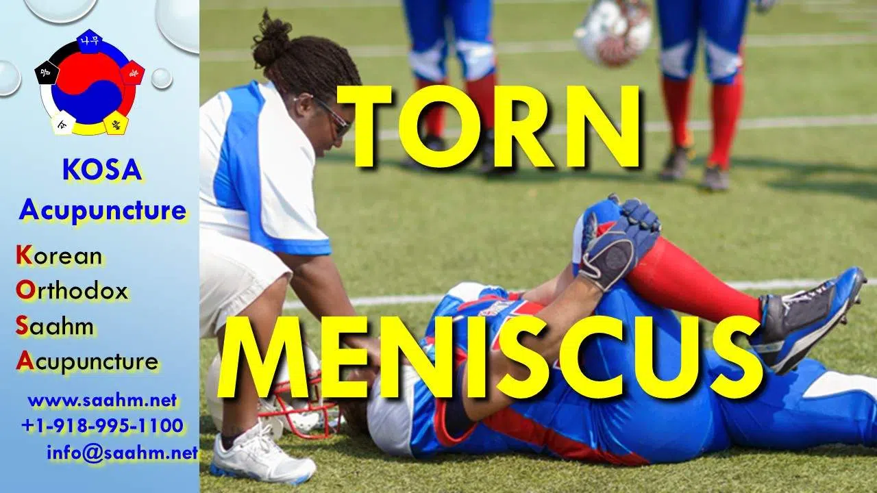 Master Kim at KOSA Acupuncture is good at treating Meniscus Tear Pain