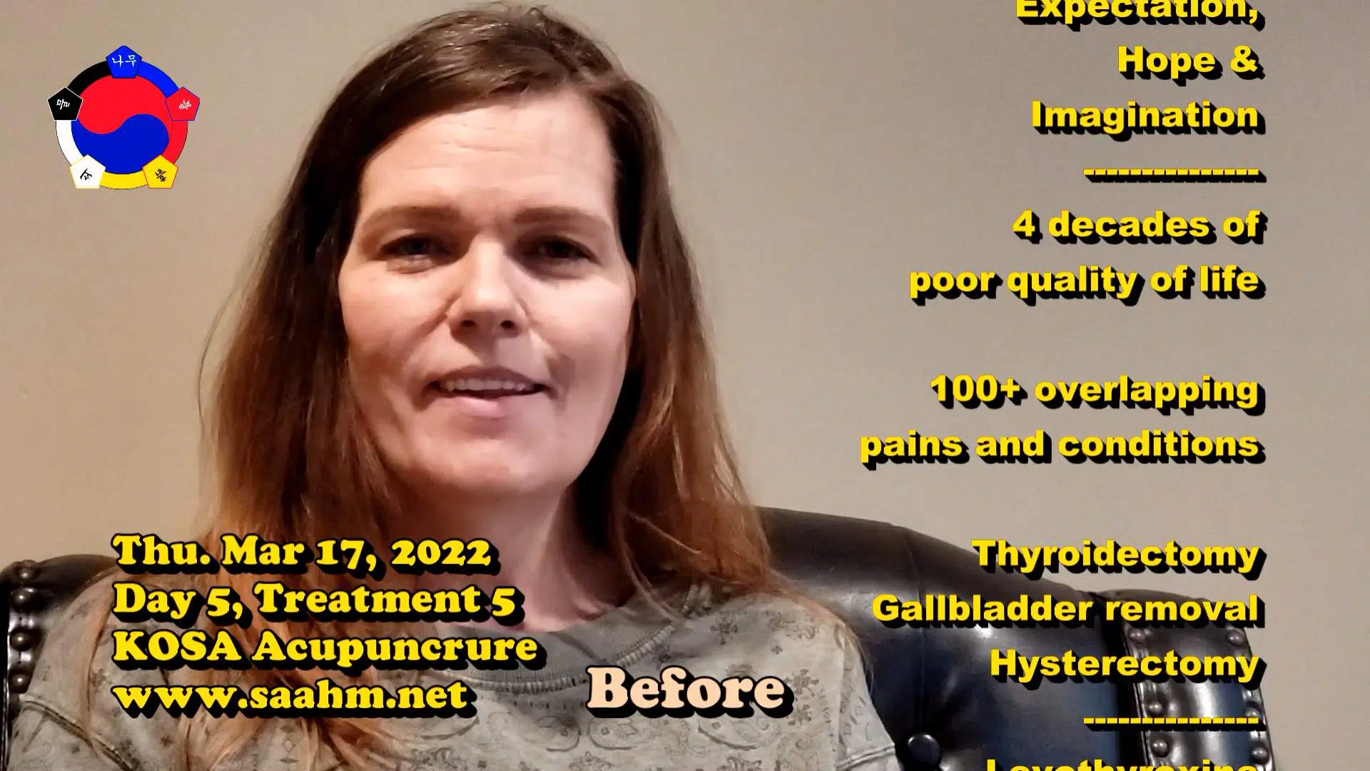 KOSA Acupuncture For A Better Quality Of Life #05 - Day 5, Tx 5 - Video Testimonial