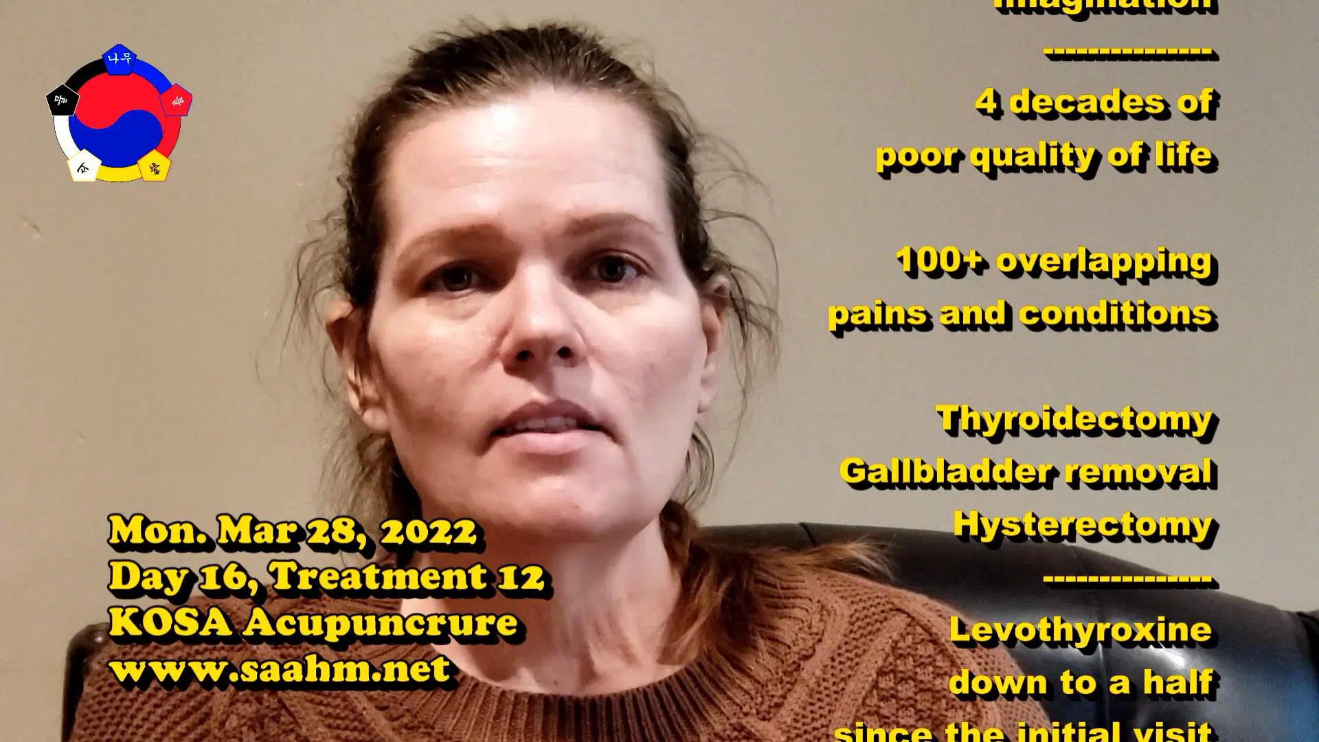 KOSA Acupuncture For A Better Quality Of Life #12 - Day 16, Tx 12 - Video Testimonial