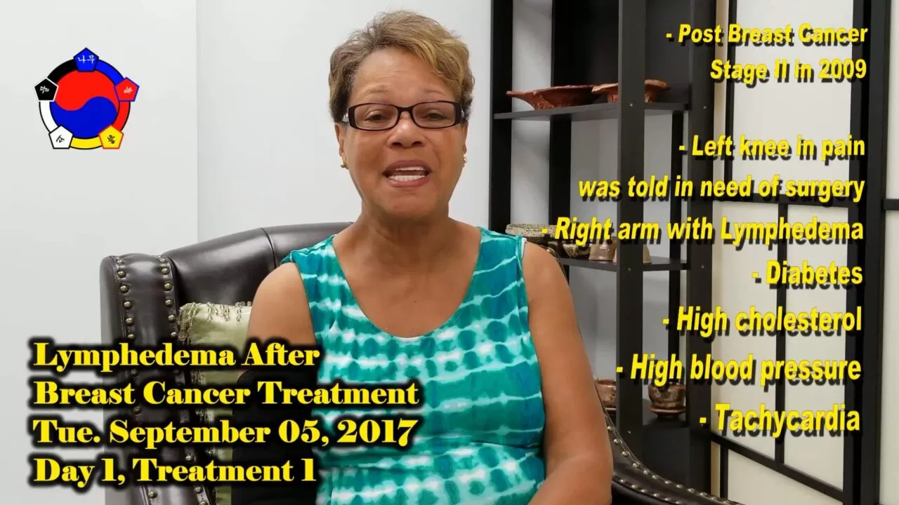 Testimonial On Lymphedema After Breast Cancer Treatment