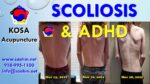 Walking Tall - ADHD, Scoliosis & TMJ - Video Testimonial - KOSA Acupuncture