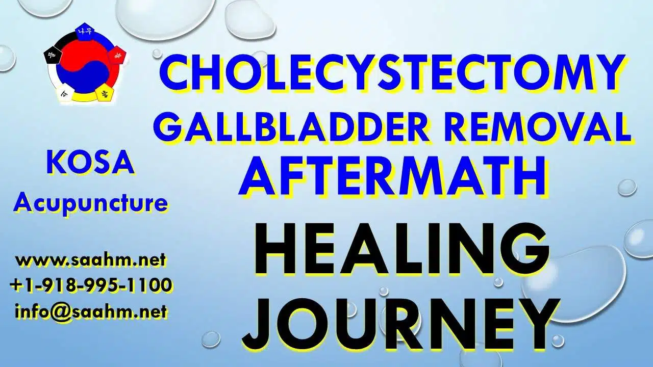 ​Cholecystectomy​ Aftermath Testimonial - KOSA Acupuncture