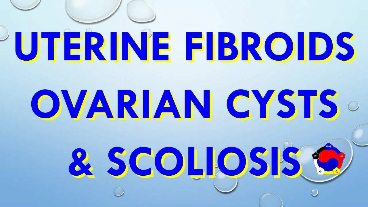 Uterine fibroids, Ovarian Cysts & Scoliosis Testimonial