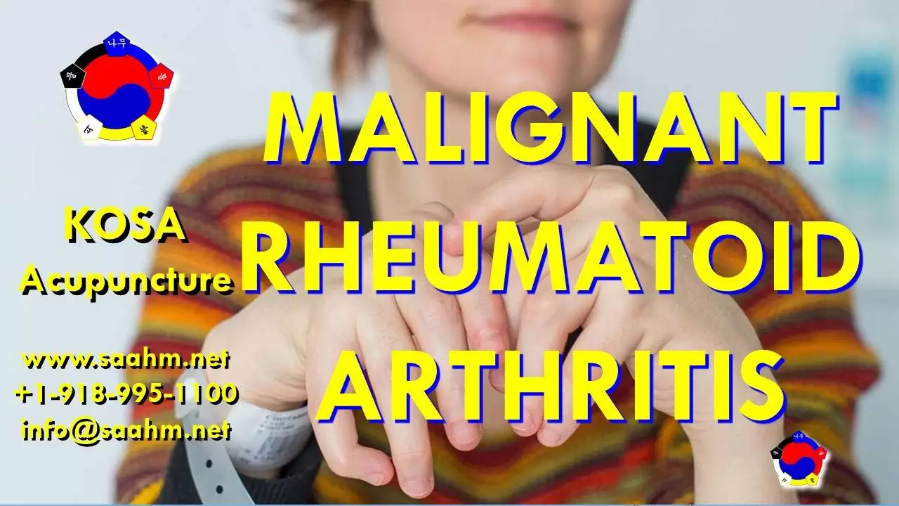 Malignant Rheumatoid Arthritis Treatment By KOSA Acupuncture